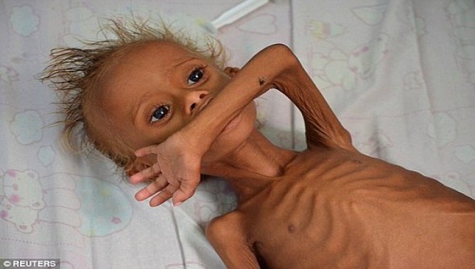 Yemen bu haldeyken 1 aylık gıda çürüyor